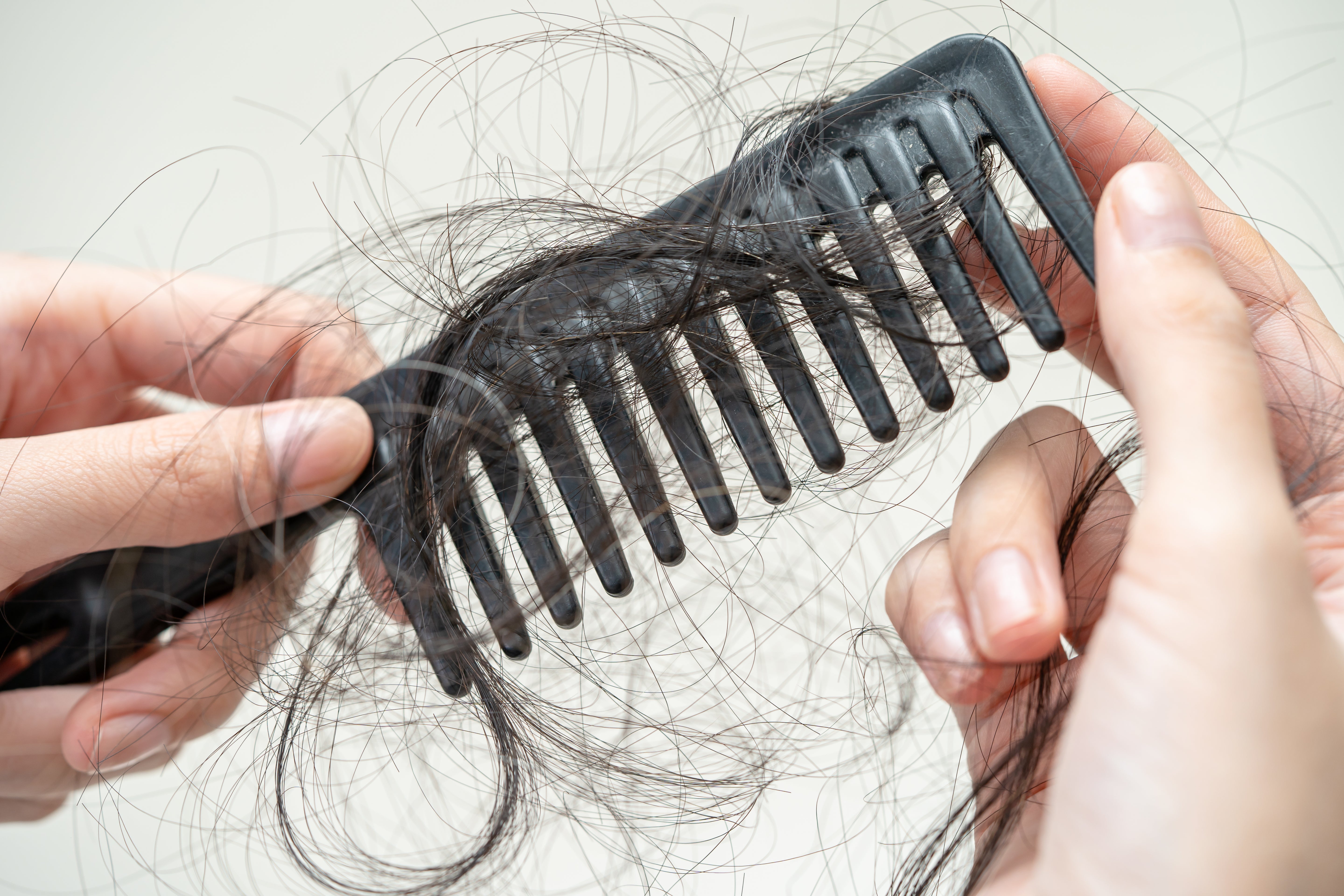 Capelli grassi estate: lavarli meno è la soluzione ideale
